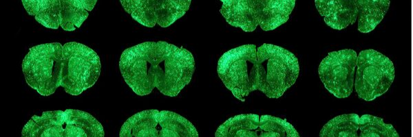 <p>Dose escalation of AAV-PHP.B in the mouse brain following intravenous and intra-arterial delivery</p>
