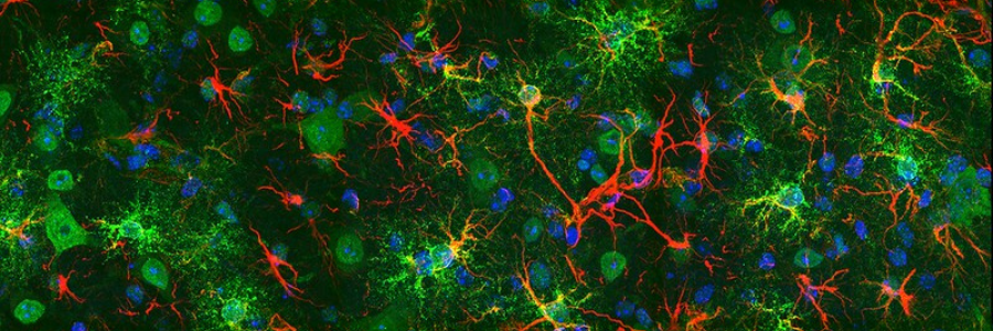 <p>Microscopy of spinal cord sample from a mouse model of neurodegeneration. Credit: NICHD/NIH, J. Gluski & C. Le Pichon C.</p>
